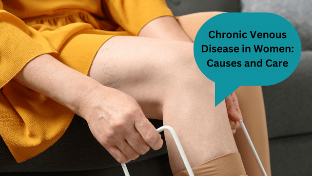 Discover the causes and effective care strategies for Chronic Venous Disease in Women. This informative article provides insights and solutions for managing this condition.